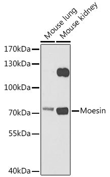 Moesin Rabbit pAb