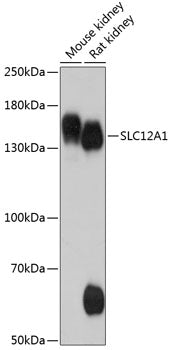 SLC12A1 Rabbit pAb