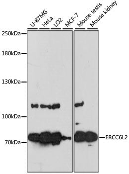 ERCC6L2 Rabbit pAb