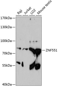 ZNF551 Rabbit pAb