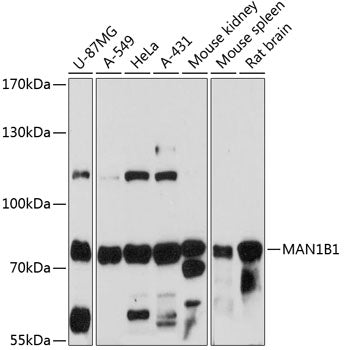 MAN1B1 Rabbit pAb