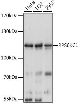 RPS6KC1 Rabbit pAb