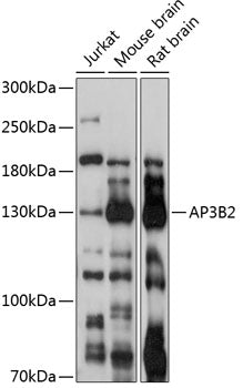 AP3B2 Rabbit pAb
