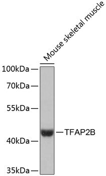 TFAP2B Rabbit pAb