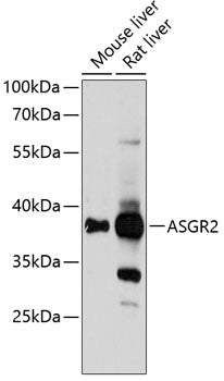 ASGR2 Rabbit pAb