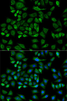 Haptoglobin (HP) Rabbit pAb