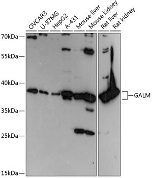 GALM Rabbit pAb
