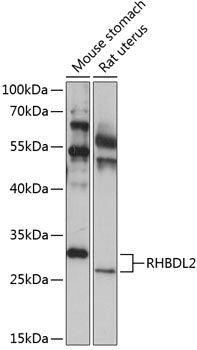 RHBDL2 Rabbit pAb