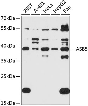 ASB5 Rabbit pAb
