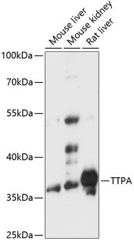TTPA Rabbit pAb