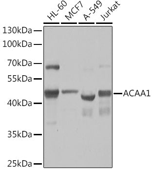 ACAA1 Rabbit pAb