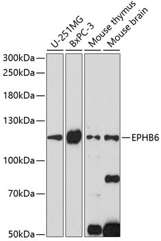 EPHB6 Rabbit pAb