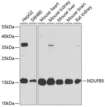 NDUFB5 Rabbit pAb