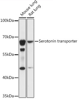 Serotonin transporter Rabbit pAb