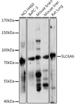 SLC6A6 Rabbit pAb
