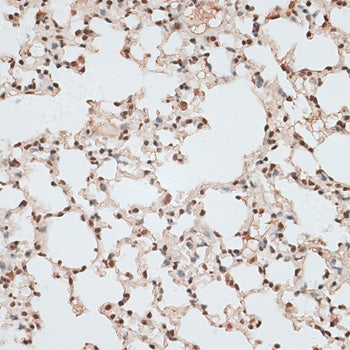 ZNF141 Rabbit pAb