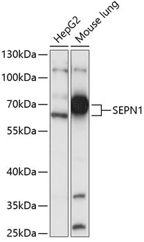 SEPN1 Rabbit pAb