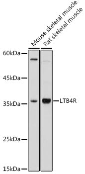 LTB4R Rabbit pAb