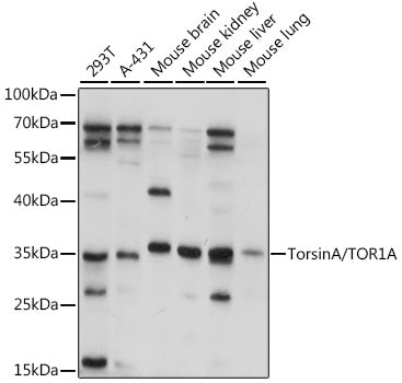 TorsinA/TOR1A Rabbit pAb