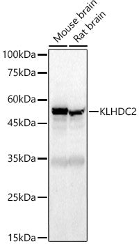 KLHDC2 Rabbit pAb