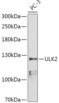 ULK2 Rabbit pAb