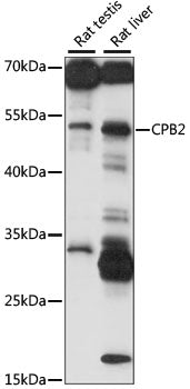 CPB2 Rabbit pAb