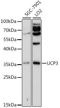 UCP3 Rabbit pAb