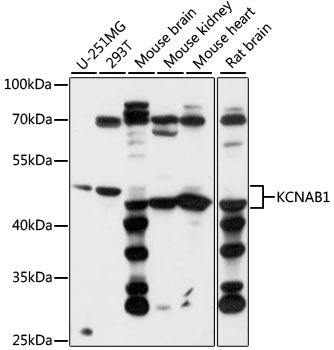 KCNAB1 Rabbit pAb