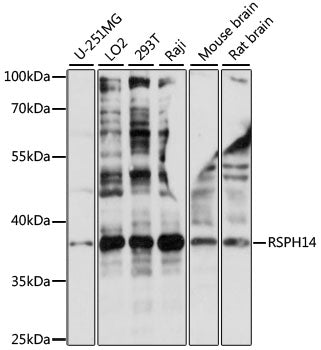 RSPH14 Rabbit pAb