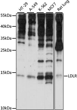 SNRNP25 Rabbit pAb