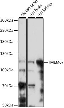TMEM67 Rabbit pAb