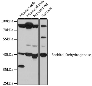 Sorbitol Dehydrogenase Rabbit pAb