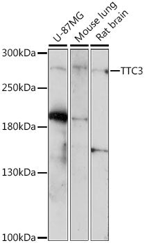 TTC3 Rabbit pAb