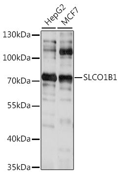 SLCO1B1 Rabbit pAb
