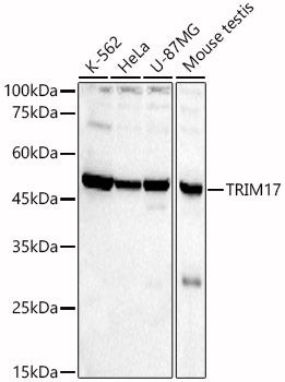 TRIM17 Rabbit pAb