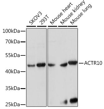 ACTR10 Rabbit pAb