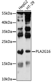 PLA2G16 Rabbit pAb