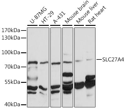 FATP4/SLC27A4 Rabbit pAb
