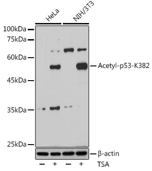 Acetyl-p53-K382 Rabbit mAb