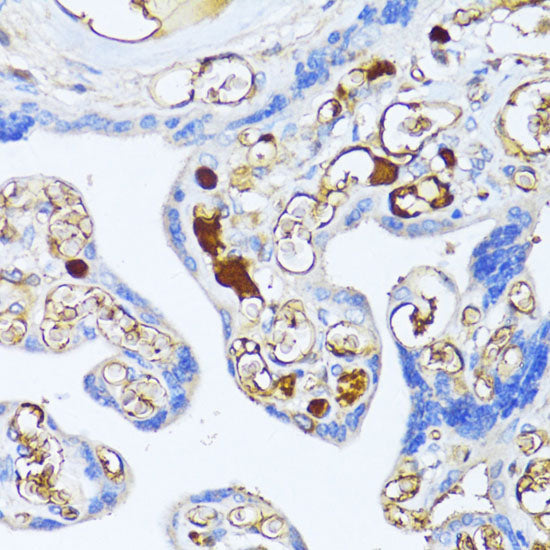 Alpha-2-Macroglobulin (A2M) Rabbit pAb