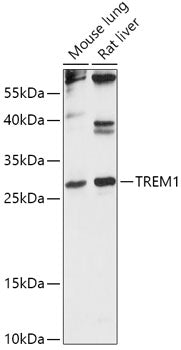 TREM1 Rabbit pAb