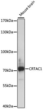 CRTAC1 Rabbit pAb