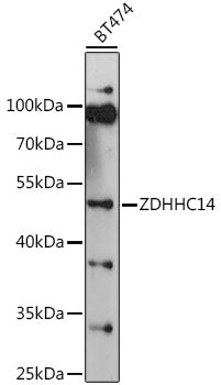 ZDHHC14 Rabbit pAb
