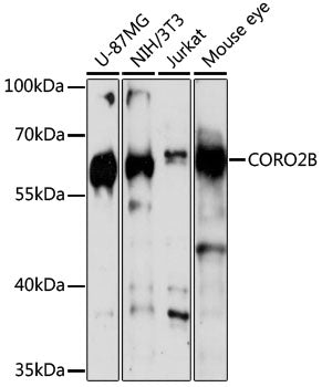 CORO2B Rabbit pAb