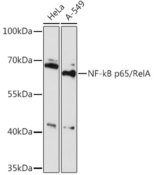 NF-kB p65/RelA Rabbit pAb