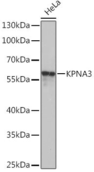 KPNA3 Rabbit pAb