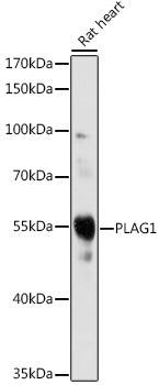 PLAG1 Rabbit pAb