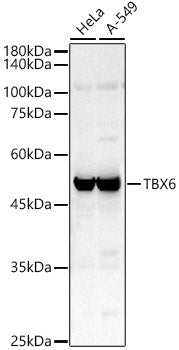 TBX6 Rabbit pAb