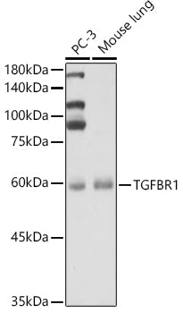 TGF beta Receptor I (TGFBR1) Rabbit pAb