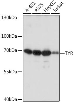Tyrosinase Rabbit pAb